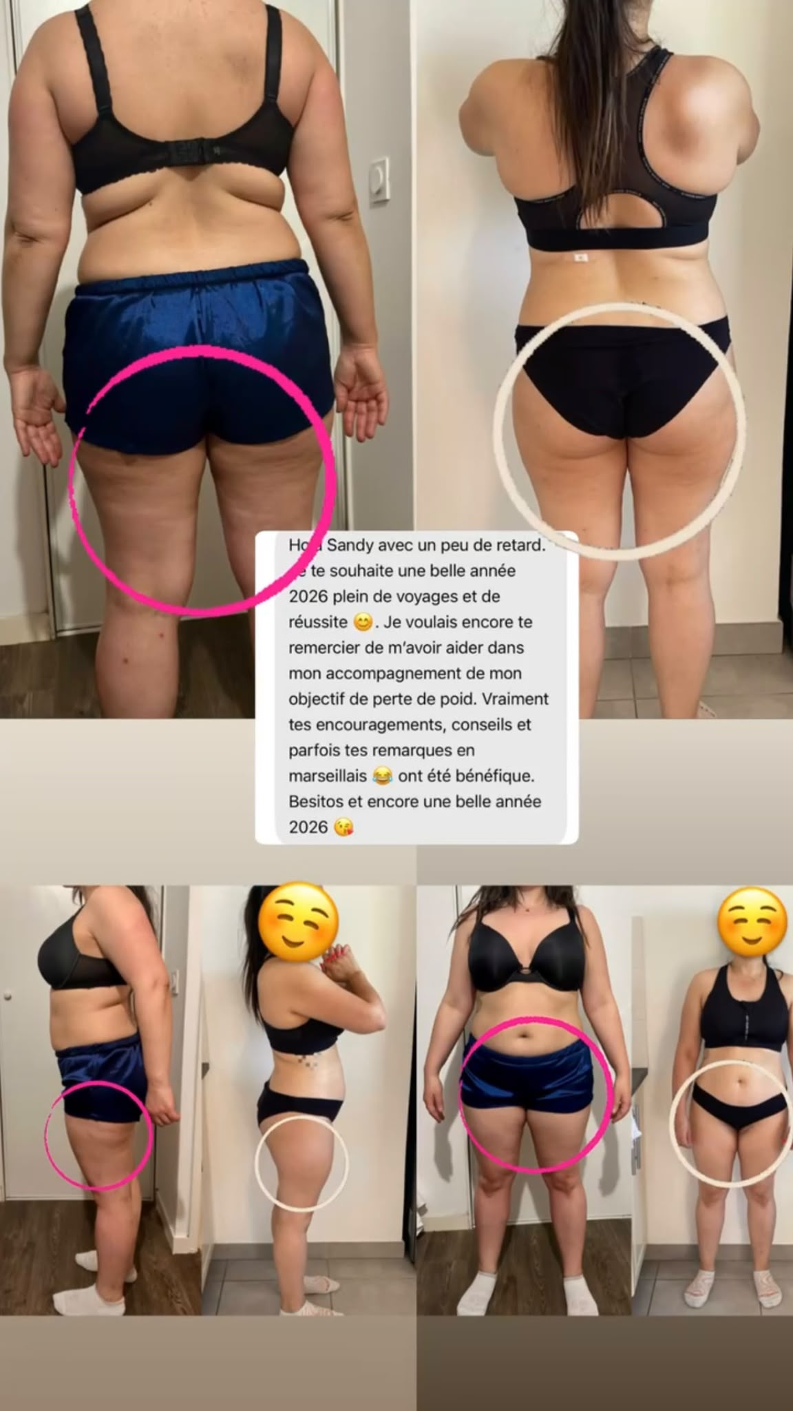 Photos avant/après d'une cliente Sanoafit montrant sa perte de poids grâce au programme Un Temps Pour Moi