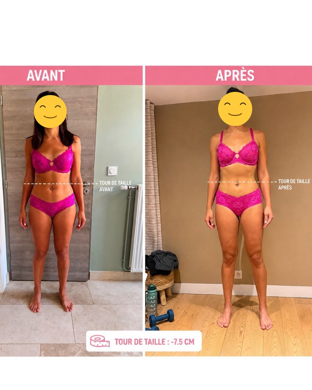 Photo avant/après de face d'une cliente Sanoafit, visage masqué pour préserver son anonymat